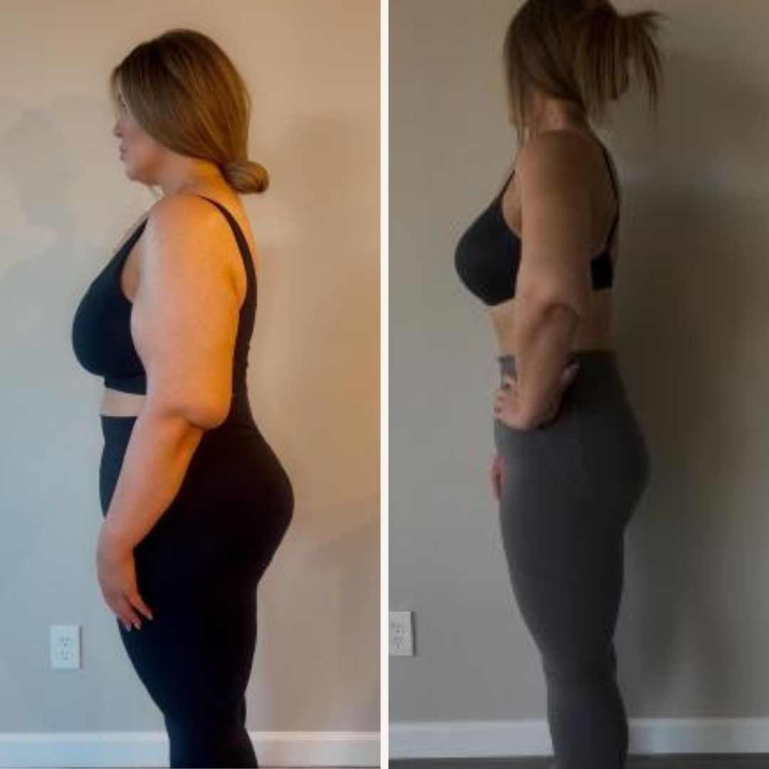 Kristen's before and after: side profile showing dramatic weight loss.